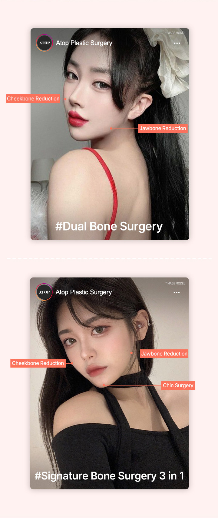 ★韓国大人気★【SURGERY】process 032 Plastic Surgery Korea] Breast, Eyes, Contouring Part 2 - YouTube